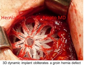 Diapositiva10