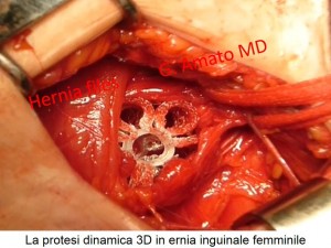 Diapositiva9